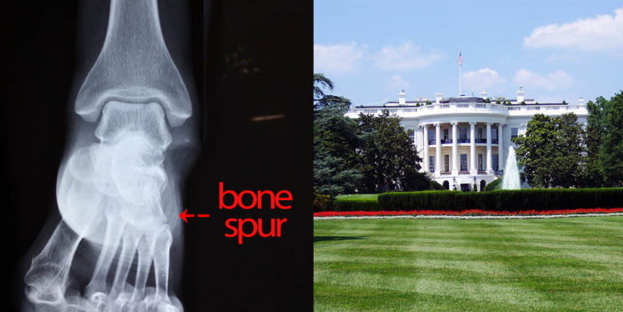 Bone Spur Attack Forces President To Abandon Gun Legislation